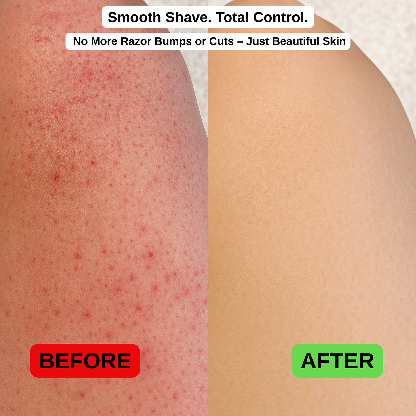 SureGrip™ – Shower Foot Rest for Easy Shaving & Washing